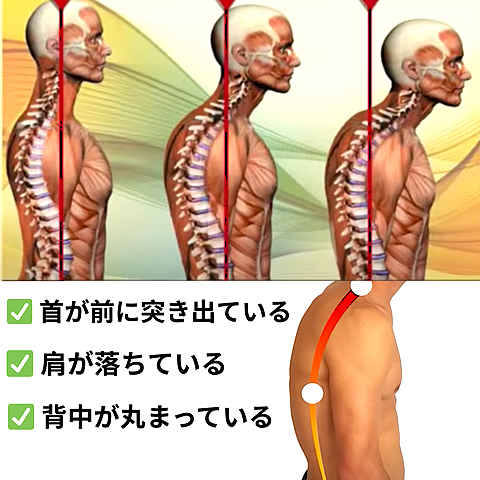 PosturePro™ 姿勢矯正ベルト